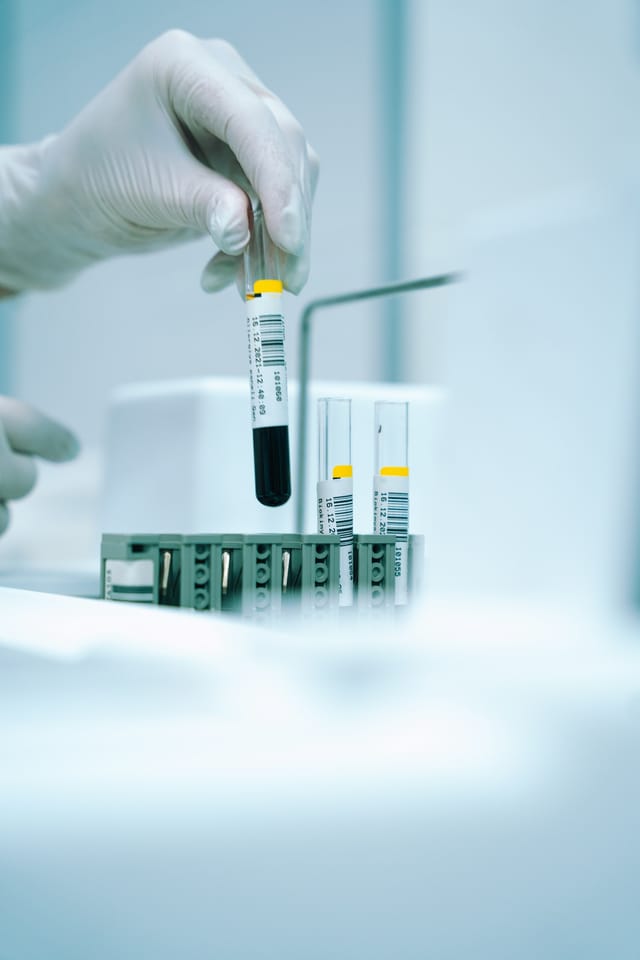 Un tubo de análisis de sangre en el laboratorio